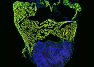 Fokus Forschung - Regeneration der Herzzellen in Zebrafischen